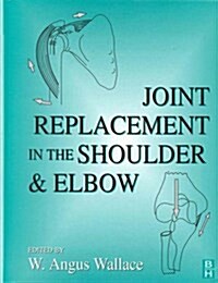 Joint Replacement in the Shoulder and Elbow (Hardcover)