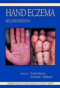 Hand Eczema (Hardcover, 2nd, Subsequent)