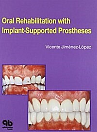 Oral Rehabilitation With Implant-Supported Prostheses (Hardcover)