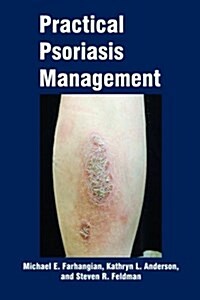 Practical Psoriasis Management (Paperback)