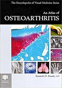 An Atlas of Obsteoarthritis (Hardcover, Illustrated)