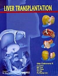 Liver Transplantation (Hardcover, 1st)