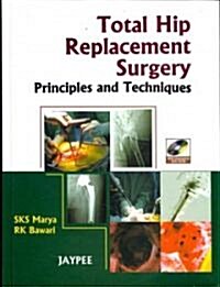 Total Hip Replacement Surgery (Hardcover, DVD-ROM, 1st)