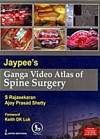 Jaypees Ganga Video Atlas of Spine Surgery (Hardcover)