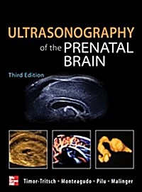 Ultrasonography of the Prenatal Brain (Hardcover, 3)