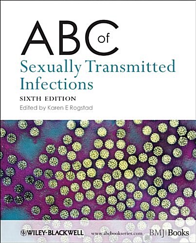 ABC of Sexually Transmitted Infections (Paperback, 6)