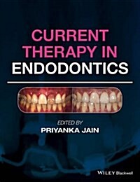 Current Therapy in Endodontics (Hardcover)