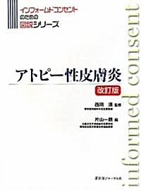 アトピ-性皮膚炎 (インフォ-ムドコンセントのための圖說シリ-ズ) (改訂版, 大型本)