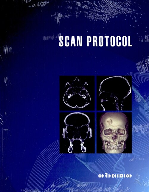 Scan Protocol
