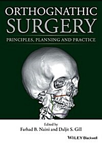 Orthognathic Surgery: Principles, Planning and Practice (Hardcover)