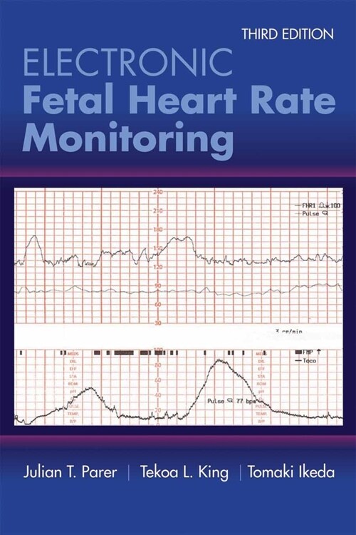 Electronic Fetal Heart Rate Monitoring: The 5-Tier System: The 5-Tier System (Paperback, 3)