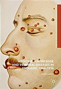 Medicine, Knowledge and Venereal Diseases in England, 1886-1916 (Hardcover, 2016)
