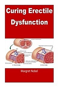 Curing Erectile Dysfunction: Natural Way to Cure Erectile Dysfuntion (Paperback)