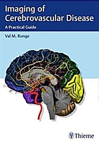 Imaging of Cerebrovascular Disease: A Practical Guide (Paperback)
