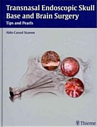 Transnasal Endoscopic Skull Base and Brain Surgery: Tips and Pearls (Hardcover)