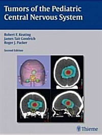 Tumors of the Pediatric Central Nervous System (Hardcover, 2)
