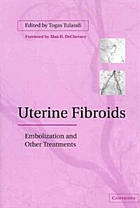 Uterine Fibroids : Embolization and Other Treatments (Paperback)