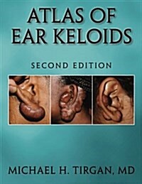 Atlas of Ear Keloids - Second Edition (Paperback)