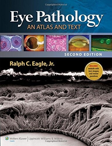 Eye Pathology: An Atlas and Text [With Web Access] (Hardcover, 2)