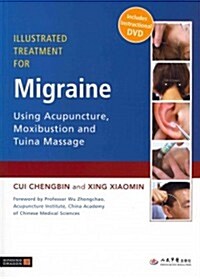 Illustrated Treatment for Migraine Using Acupuncture, Moxibustion and Tuina Massage (Paperback)