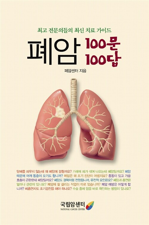 폐암 100문 100답