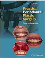 Practical Periodontal Plastic Surgery (Hardcover, 2)