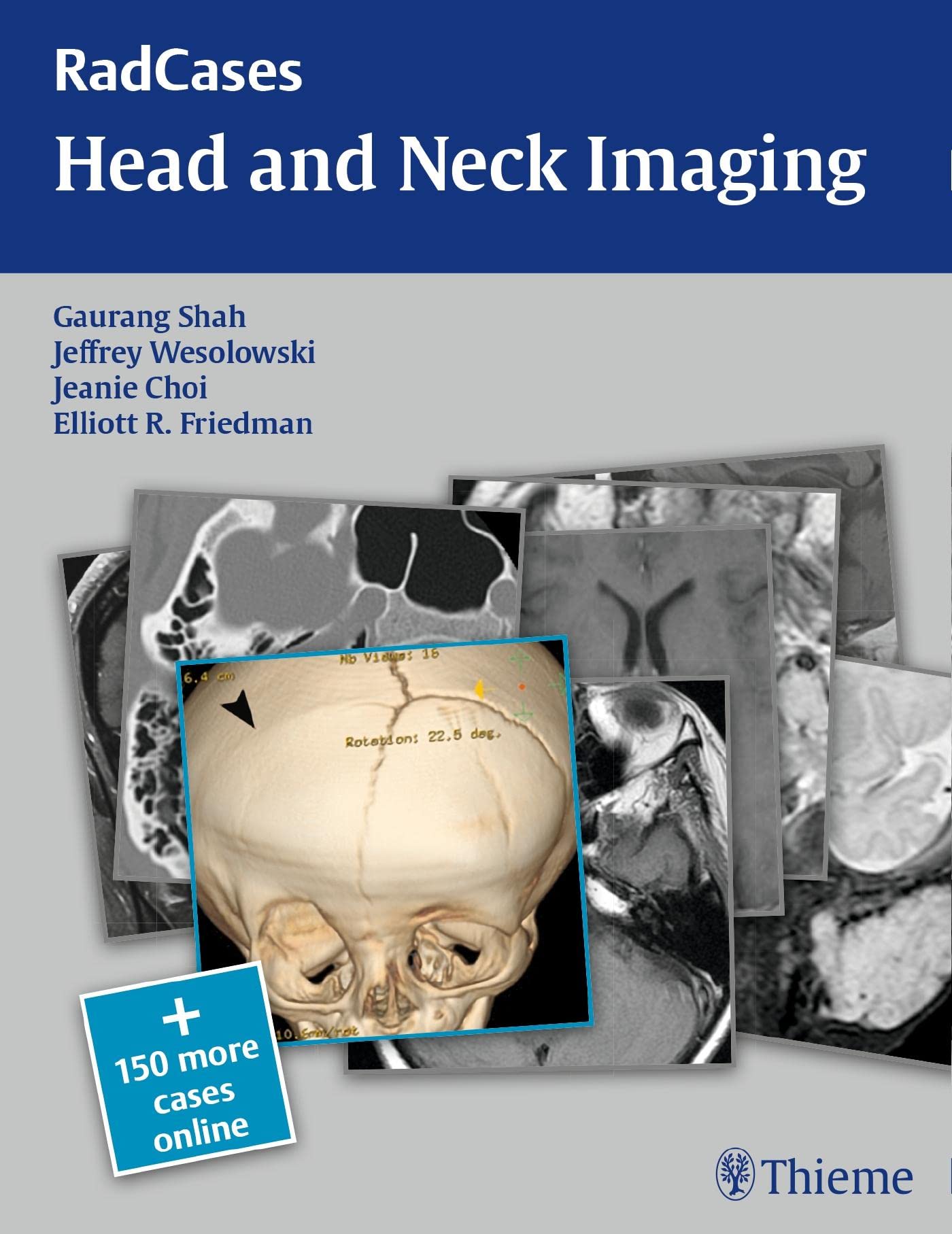 Radcases Head and Neck Imaging (Paperback)