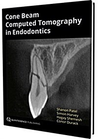 Cone Beam Computed Tomography in Endodontics (Hardcover)