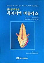 권소란 박사의 치아미백 아틀라스 - 전2권