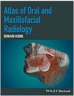 Atlas of Oral and Maxillofacial Radiology (Hardcover)
