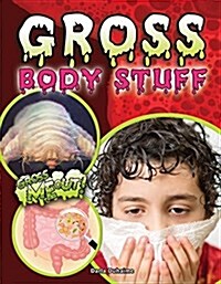 Gross Body Stuff (Paperback)