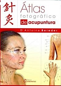 Atlas Fotografico de Acupuntura (Hardcover)