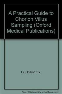 A Practical guide to chorion villus sampling