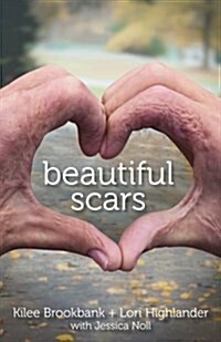 Beautiful Scars (Paperback)