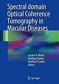 Spectral Domain Optical Coherence Tomography in Macular Diseases (Hardcover, 2016)