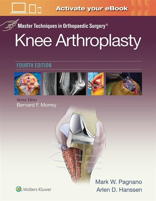 Master Techniques in Orthopedic Surgery: Knee Arthroplasty (Hardcover)
