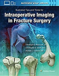 Illustrated Tips and Tricks for Intraoperative Imaging in Fracture Surgery (Hardcover)