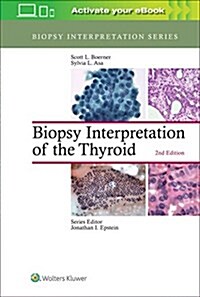 Biopsy Interpretation of the Thyroid (Hardcover)