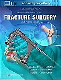 Harborview Illustrated Tips and Tricks in Fracture Surgery (Hardcover, 2)