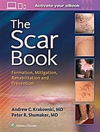 The Scar Book: Formation, Mitigation, Rehabilitation and Prevention (Hardcover)