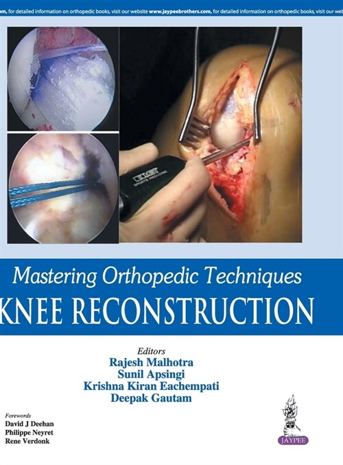 Mastering Orthopedic Techniques: Knee Reconstruction (Hardcover)