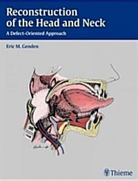 Reconstruction of the Head and Neck: A Defect-Oriented Approach (Hardcover)
