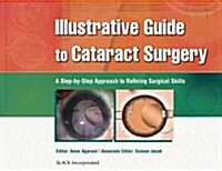 Illustrative Guide to Cataract Surgery: A Step-By-Step Approach to Refining Surgical Skills (Hardcover)