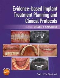 Evidence-based implant treatment planning and clinical protocols