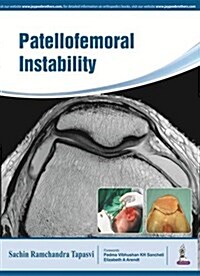 Patellofemoral Instability: Knee Joint (Paperback)