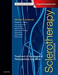 Sclerotherapy: Treatment of Varicose and Telangiectatic Leg Veins (Hardcover, 6)
