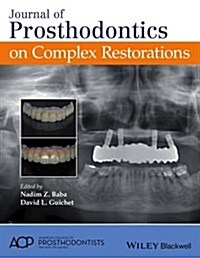 Journal of Prosthodontics on Complex Restorations (Hardcover)
