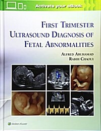 First Trimester Ultrasound Diagnosis of Fetal Abnormalities (Hardcover)