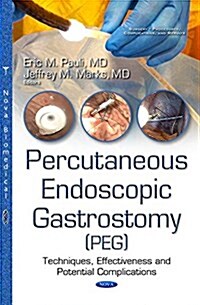Percutanous Endoscopic Gastrostomy (Peg) (Hardcover, UK)