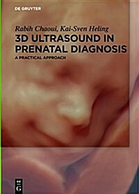 3D Ultrasound in Prenatal Diagnosis: A Practical Approach (Hardcover)